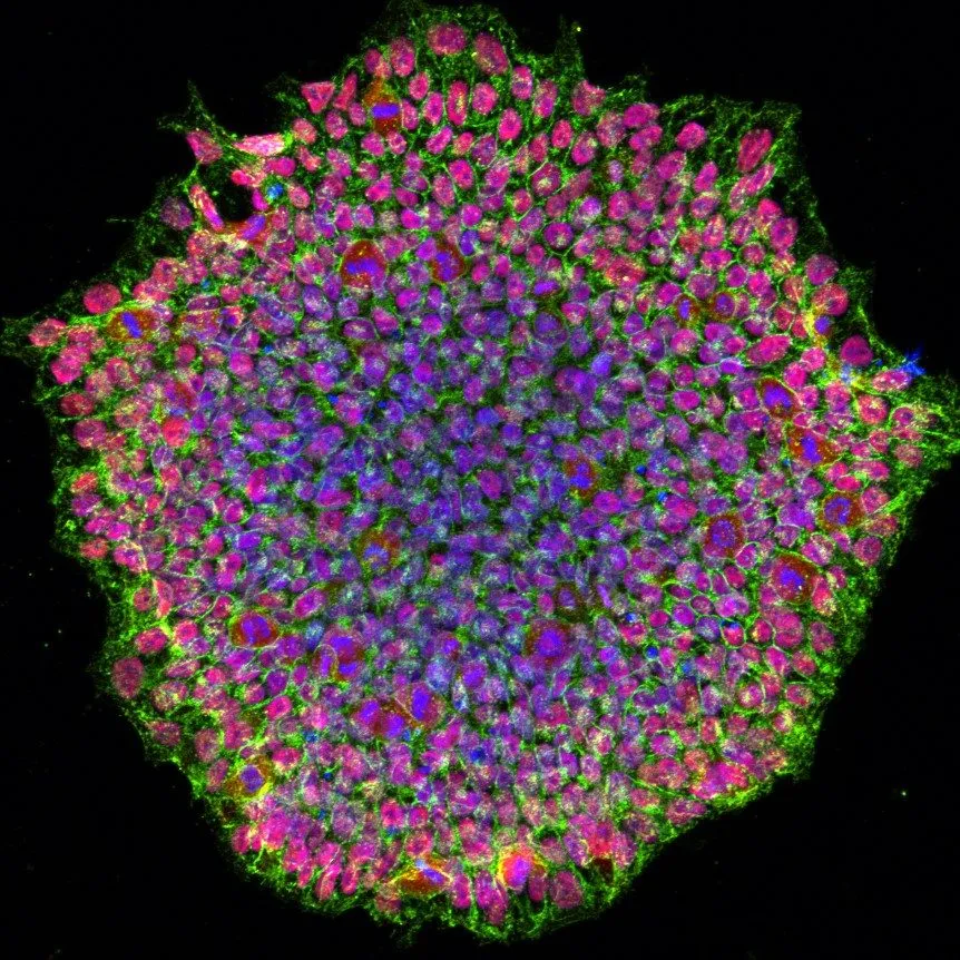 A round, densely packed colony of cells glowing magenta, violet and green on a black background.
