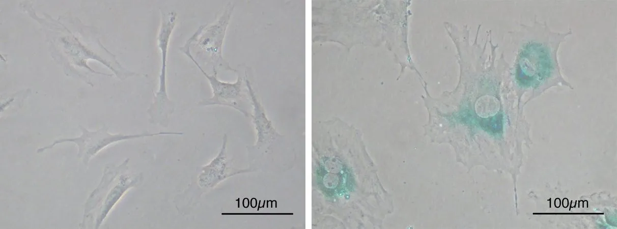 Two microscope images side by side: on the left, slim spindle-shaped cells; on the right, large flattened cells with blue-green stain around their nuclei.