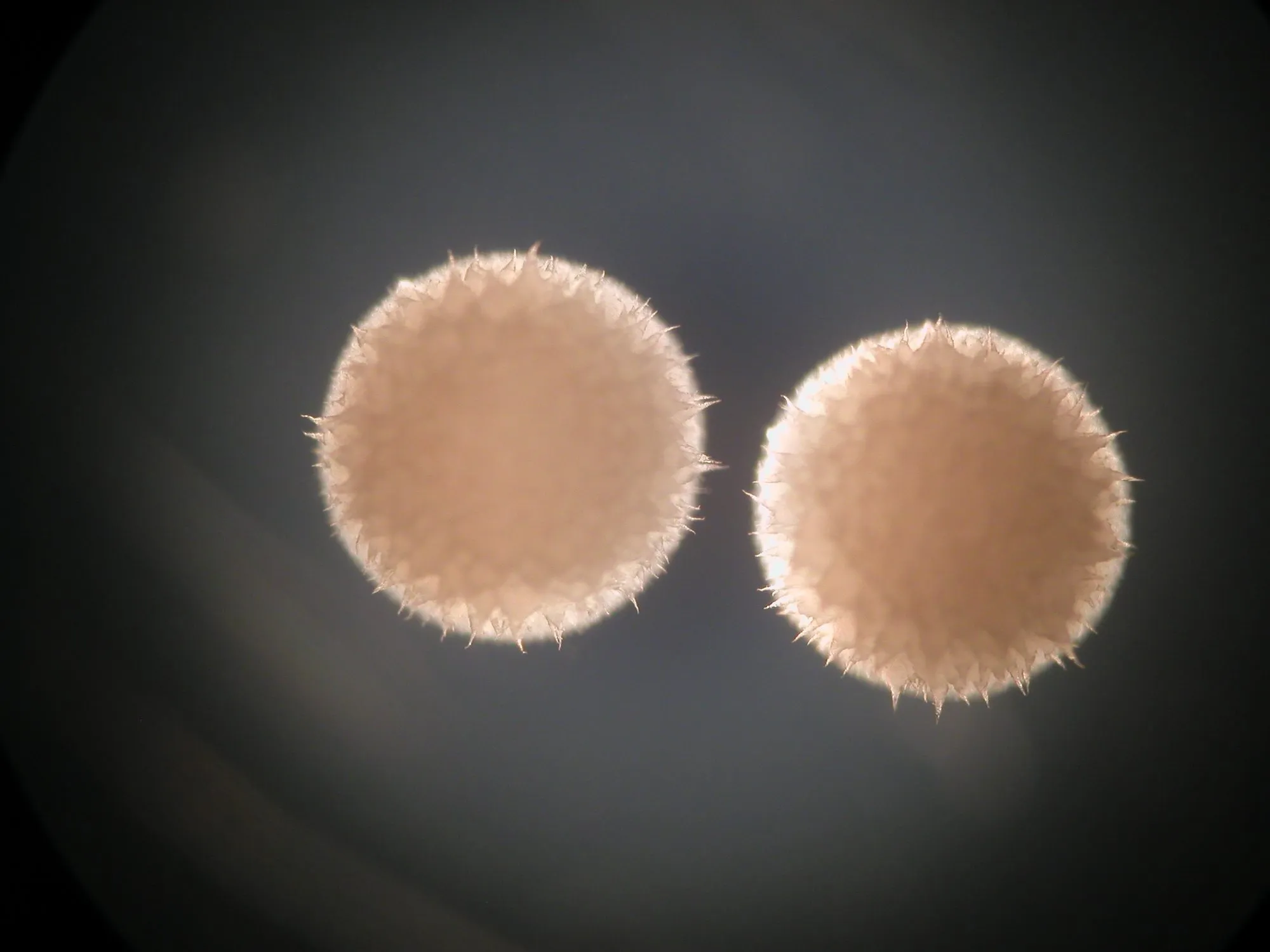 Two round, fuzzy, peach-coloured bacterial colonies with spiky edges glowing against a dark agar background.